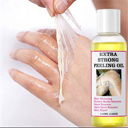 Extra Strong Peeling Exfoliating Yellow Skin Oil