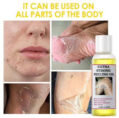 Extra Strong Peeling Exfoliating Yellow Skin Oil