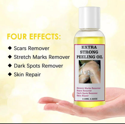 Extra Strong Peeling Exfoliating Yellow Skin Oil