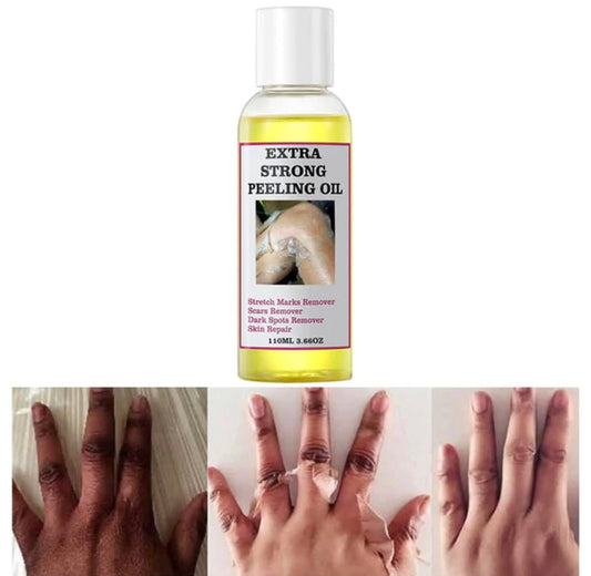 Extra Strong Peeling Exfoliating Yellow Skin Oil